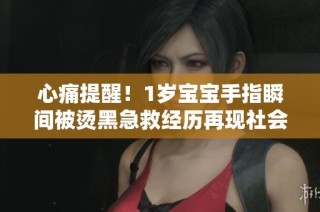 心痛提醒！1岁宝宝手指瞬间被烫黑急救经历再现社会警示
